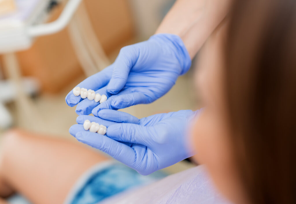 a dental professional holding a set of porcelain veneers.