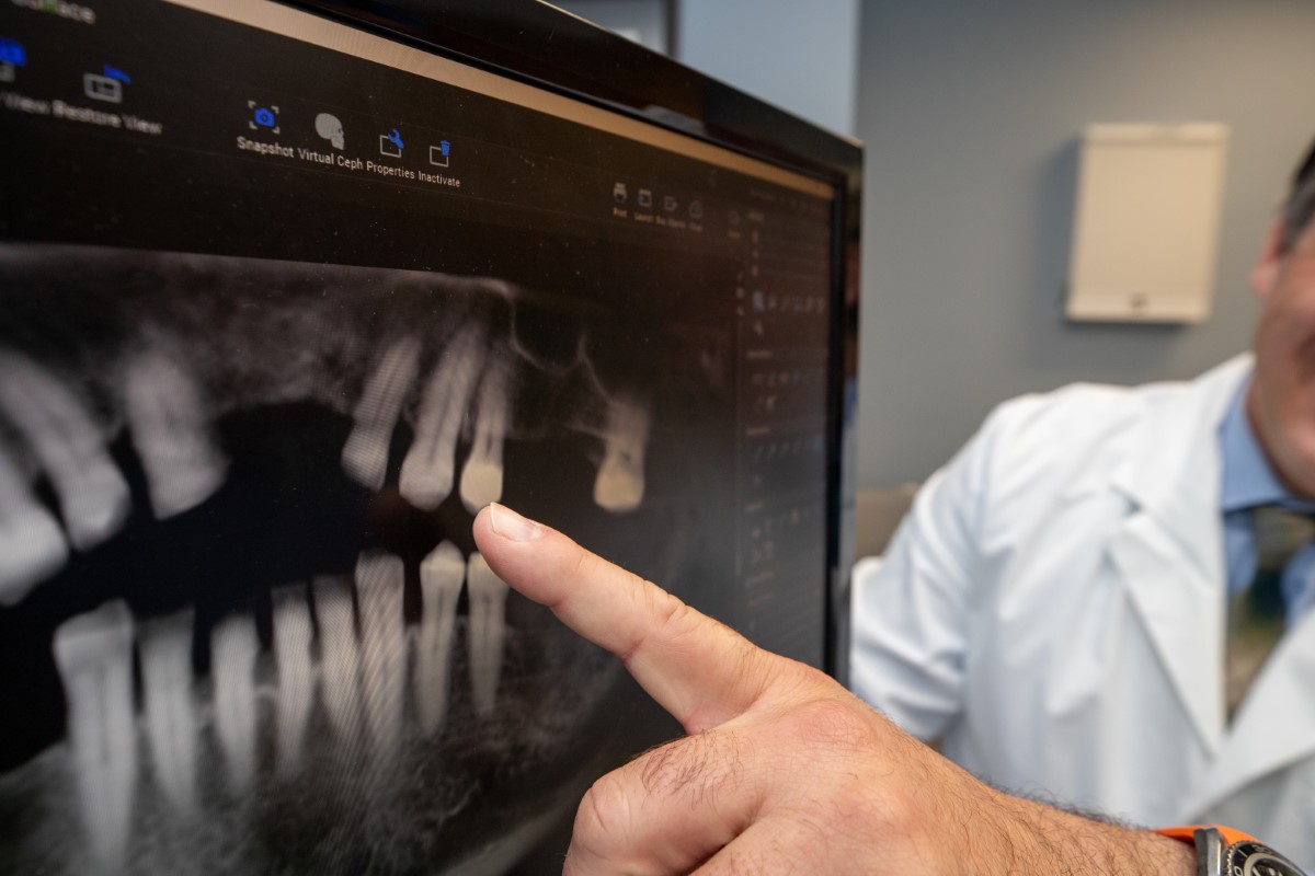 Dr Joseph Collins II Showing A Dental Patient An XRay Of Their Mouth With Missing Teeth