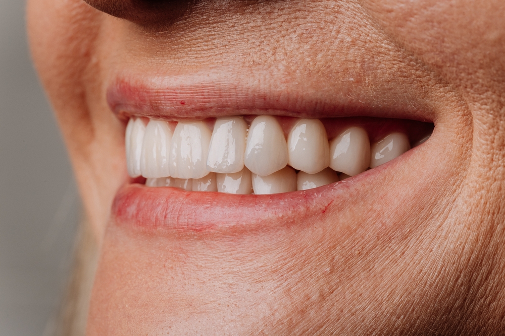 Close-up of a dentist holding a porcelain veneer, with a patient smiling in the background, to highlight the natural look of the veneer. No text on the image.