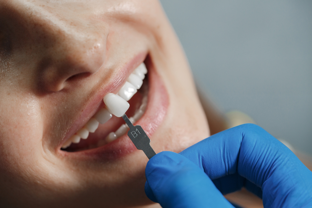 dental-implants-eligibility-are-you-the-right-candidate
