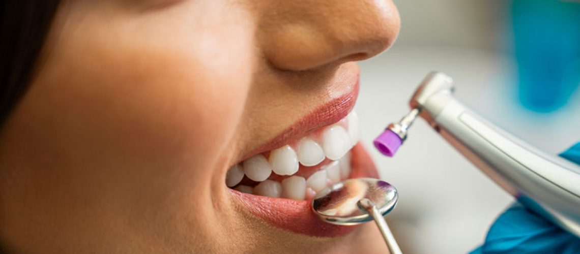 Closeup shot of a women getting a teeth whitening treatment, young woman patient.