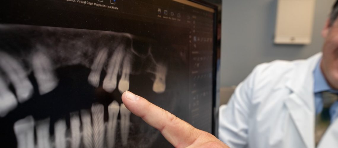 Dr Joseph Collins II Showing A Dental Patient An XRay Of Their Mouth With Missing Teeth