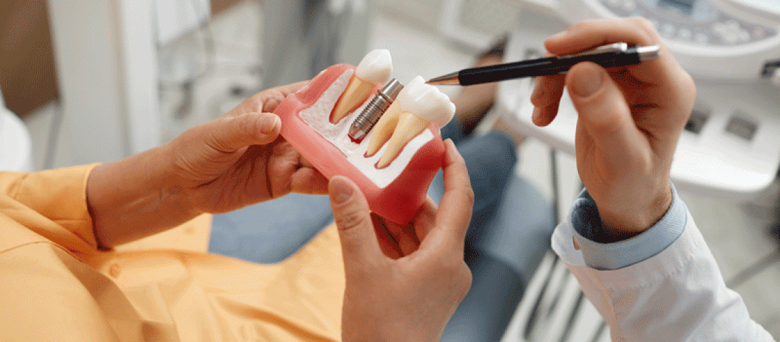 Woman holding tooth model during consultation on dental implant.