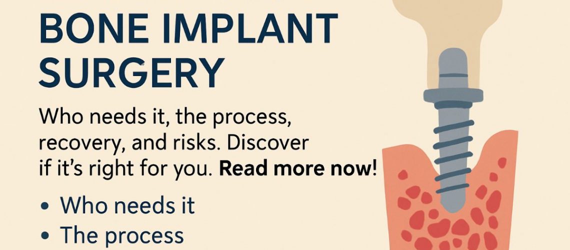 Image of a dentist explaining a bone implant surgery procedure using a 3D model of a jaw with implants. The dentist is pointing to the area where the bone graft will be placed. No text on the image.