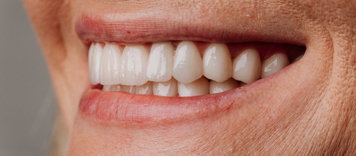 Close-up of a dentist holding a porcelain veneer, with a patient smiling in the background, to highlight the natural look of the veneer. No text on the image.